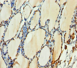 H2AFY / MACROH2A1 Antibody - Immunohistochemistry of paraffin-embedded human thyroid tissue at dilution 1:100