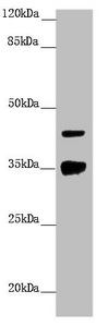 H2AFY / MACROH2A1 Antibody - Western blot All Lanes:H2AFY antibody at 1.43 ug/ml +Hela whole cell lysate Secondary Goat polyclonal to rabbit IgG at 1/10000 dilution Predicted band size: 40 kDa Observed band size: 40,35 kDa