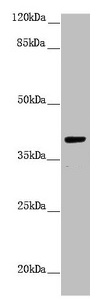 H2AFY / MACROH2A1 Antibody - Western blot All lanes: H2AFY antibody at 1.43µg/ml + Hela whole cell lysate Secondary Goat polyclonal to rabbit IgG at 1/10000 dilution Predicted band size: 40 kDa Observed band size: 40 kDa