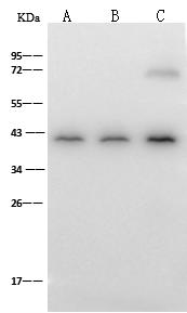 H2AFY / MACROH2A1 Antibody - Anti-H2AFY rabbit polyclonal antibody at 1:500 dilution. Lane A: HeLa Whole Cell Lysate. Lane B: HepG2 Whole Cell Lysate. Lane C: MCF7 Whole Cell Lysate. Lysates/proteins at 30 ug per lane. Secondary: Goat Anti-Rabbit IgG (H+L)/HRP at 1/10000 dilution. Developed using the ECL technique. Performed under reducing conditions. Predicted band size: 40 kDa. Observed band size: 40 kDa.