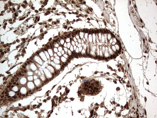 H2AFY2 Antibody - IHC of paraffin-embedded Human colon tissue using anti-H2AFY2 mouse monoclonal antibody. (Heat-induced epitope retrieval by 1 mM EDTA in 10mM Tris, pH8.5, 120°C for 3min).