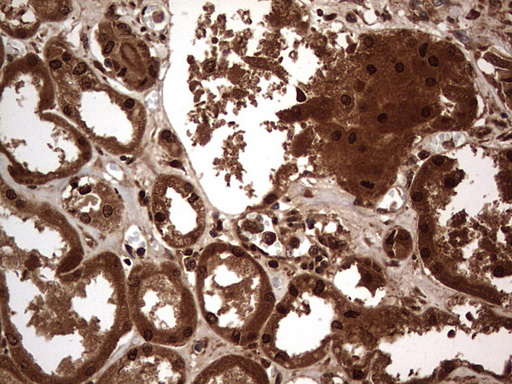 H2AFY2 Antibody - IHC of paraffin-embedded Human Kidney tissue using anti-H2AFY2 mouse monoclonal antibody. (Heat-induced epitope retrieval by 1 mM EDTA in 10mM Tris, pH8.5, 120°C for 3min).