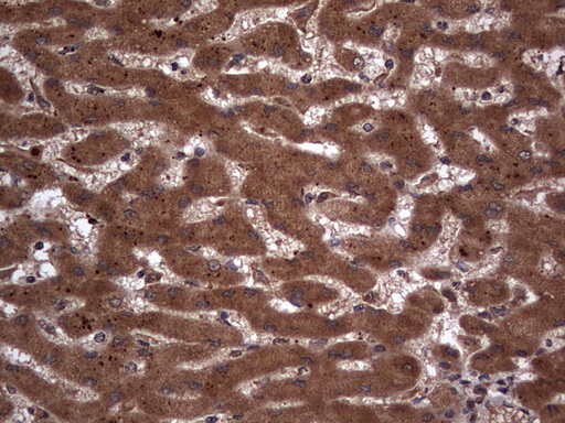 H2AFY2 Antibody - IHC of paraffin-embedded Human liver tissue using anti-H2AFY2 mouse monoclonal antibody. (Heat-induced epitope retrieval by 1 mM EDTA in 10mM Tris, pH8.5, 120°C for 3min).