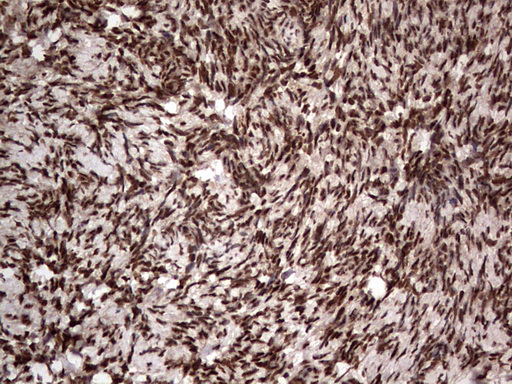 H2AFY2 Antibody - IHC of paraffin-embedded Human Ovary tissue using anti-H2AFY2 mouse monoclonal antibody. (Heat-induced epitope retrieval by 1 mM EDTA in 10mM Tris, pH8.5, 120°C for 3min).
