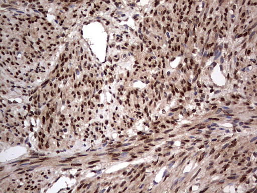 H2AFY2 Antibody - IHC of paraffin-embedded Human endometrium tissue using anti-H2AFY2 mouse monoclonal antibody. (Heat-induced epitope retrieval by 1 mM EDTA in 10mM Tris, pH8.5, 120°C for 3min).