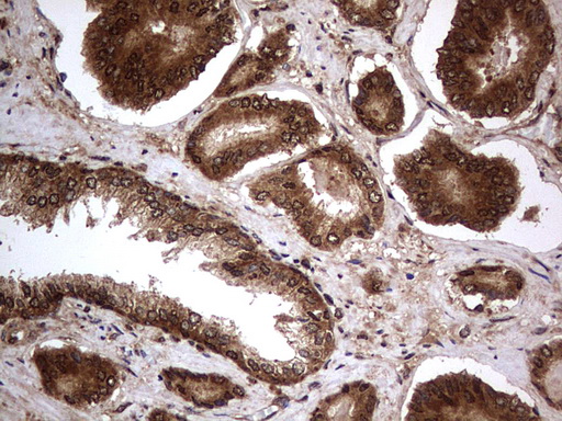 H2AFY2 Antibody - IHC of paraffin-embedded Human prostate tissue using anti-H2AFY2 mouse monoclonal antibody. (Heat-induced epitope retrieval by 1 mM EDTA in 10mM Tris, pH8.5, 120°C for 3min).