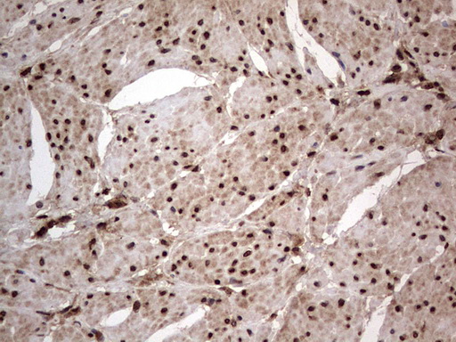 H2AFY2 Antibody - IHC of paraffin-embedded Human bladder tissue using anti-H2AFY2 mouse monoclonal antibody. (Heat-induced epitope retrieval by 1 mM EDTA in 10mM Tris, pH8.5, 120°C for 3min).
