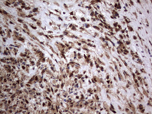H2AFY2 Antibody - IHC of paraffin-embedded Human lymph node tissue using anti-H2AFY2 mouse monoclonal antibody. (Heat-induced epitope retrieval by 1 mM EDTA in 10mM Tris, pH8.5, 120°C for 3min).
