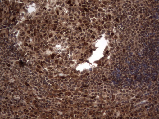 H2AFY2 Antibody - IHC of paraffin-embedded Human tonsil using anti-H2AFY2 mouse monoclonal antibody. (Heat-induced epitope retrieval by 1 mM EDTA in 10mM Tris, pH8.5, 120°C for 3min).