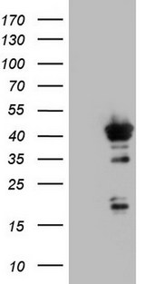 H2AFY2 Antibody - HEK293T cells were transfected with the pCMV6-ENTRY control (Left lane) or pCMV6-ENTRY H2AFY2 (Right lane) cDNA for 48 hrs and lysed. Equivalent amounts of cell lysates (5 ug per lane) were separated by SDS-PAGE and immunoblotted with anti-H2AFY2.