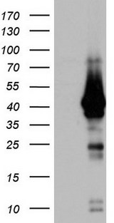 H2AFY2 Antibody - HEK293T cells were transfected with the pCMV6-ENTRY control (Left lane) or pCMV6-ENTRY H2AFY2 (Right lane) cDNA for 48 hrs and lysed. Equivalent amounts of cell lysates (5 ug per lane) were separated by SDS-PAGE and immunoblotted with anti-H2AFY2.