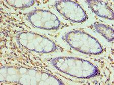 H2AFZ / H2A.z Antibody - Immunohistochemistry of paraffin-embedded human rectum using antibody at 1:100 dilution.