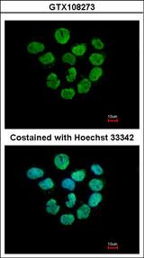 H2AFZ / H2A.z Antibody - Immunofluorescence of paraformaldehyde-fixed A431 using Histone H2A.Z antibody at 1:500 dilution.