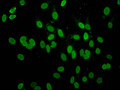 H2AFZ / H2A.z Antibody - Immunofluorescence staining of Hela cells at a dilution of 1:10, counter-stained with DAPI. The cells were fixed in 4% formaldehyde, permeabilized using 0.2% Triton X-100 and blocked in 10% normal Goat Serum. The cells were then incubated with the antibody overnight at 4 °C.The secondary antibody was Alexa Fluor 488-congugated AffiniPure Goat Anti-Rabbit IgG (H+L) .