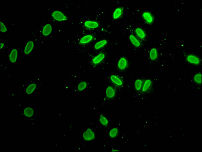 H2AFZ / H2A.z Antibody - Immunofluorescence staining of Hela cells at a dilution of 1:25, counter-stained with DAPI. The cells were fixed in 4% formaldehyde, permeabilized using 0.2% Triton X-100 and blocked in 10% normal Goat Serum. The cells were then incubated with the antibody overnight at 4 °C.The secondary antibody was Alexa Fluor 488-congugated AffiniPure Goat Anti-Rabbit IgG (H+L) .