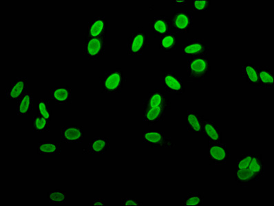 H2AFZ / H2A.z Antibody - Immunofluorescence staining of Hela cells at a dilution of 1:10, counter-stained with DAPI. The cells were fixed in 4% formaldehyde, permeabilized using 0.2% Triton X-100 and blocked in 10% normal Goat Serum. The cells were then incubated with the antibody overnight at 4°C.The secondary antibody was Alexa Fluor 488-congugated AffiniPure Goat Anti-Rabbit IgG (H+L) .