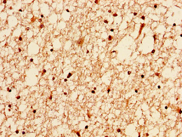 H2AFZ / H2A.z Antibody - Immunohistochemistry image at a dilution of 1:20 and staining in paraffin-embedded human brain tissue performed on a Leica BondTM system. After dewaxing and hydration, antigen retrieval was mediated by high pressure in a citrate buffer (pH 6.0) . Section was blocked with 10% normal goat serum 30min at RT. Then primary antibody (1% BSA) was incubated at 4 °C overnight. The primary is detected by a biotinylated secondary antibody and visualized using an HRP conjugated SP system.