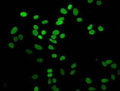 H2AFZ / H2A.z Antibody - Immunofluorescence staining of Hela cells at a dilution of 1:5, counter-stained with DAPI. The cells were fixed in 4% formaldehyde, permeabilized using 0.2% Triton X-100 and blocked in 10% normal Goat Serum. The cells were then incubated with the antibody overnight at 4 °C.The secondary antibody was Alexa Fluor 488-congugated AffiniPure Goat Anti-Rabbit IgG (H+L) .
