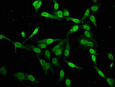 H2AFZ / H2A.z Antibody - Immunofluorescence staining of Hela cells at a dilution of 1:2.5, counter-stained with DAPI. The cells were fixed in 4% formaldehyde, permeabilized using 0.2% Triton X-100 and blocked in 10% normal Goat Serum. The cells were then incubated with the antibody overnight at 4 °C.The secondary antibody was Alexa Fluor 488-congugated AffiniPure Goat Anti-Rabbit IgG (H+L) .