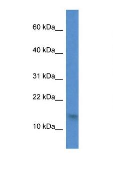H2AFZ / H2A.z Antibody - H2AFZ / Histone H2A. Z antibody Western blot of 721_B Cell lysate. Antibody concentration 1 ug/ml.  This image was taken for the unconjugated form of this product. Other forms have not been tested.