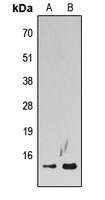 H2AFZ / H2A.z Antibody - Western blot analysis of Histone H2A.Z (AcK5) expression in K562 TSA-treated (A); HeLa TSA-treated (B) whole cell lysates.