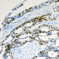 H2AFZ / H2A.z Antibody - Immunohistochemical analysis of Histone H2A.Z (AcK5) staining in human colon formalin fixed paraffin embedded tissue section. The section was pre-treated using heat mediated antigen retrieval with sodium citrate buffer (pH 6.0). The section was then incubated with the antibody at room temperature and detected using an HRP conjugated compact polymer system. DAB was used as the chromogen. The section was then counterstained with hematoxylin and mounted with DPX.