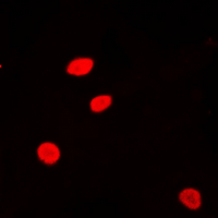 H2AFZ / H2A.z Antibody - Immunofluorescent analysis of Histone H2A.Z (AcK5) staining in HeLa cells. Formalin-fixed cells were permeabilized with 0.1% Triton X-100 in TBS for 5-10 minutes and blocked with 3% BSA-PBS for 30 minutes at room temperature. Cells were probed with the primary antibody in 3% BSA-PBS and incubated overnight at 4 ??C in a humidified chamber. Cells were washed with PBST and incubated with a DyLight 594-conjugated secondary antibody (red) in PBS at room temperature in the dark. DAPI was used to stain the cell nuclei (blue).