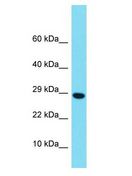 H2BFM Antibody - H2BFM antibody Western Blot of Fetal Brain. Antibody dilution: 1 ug/ml.  This image was taken for the unconjugated form of this product. Other forms have not been tested.