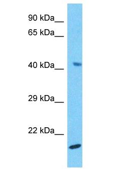 H2BFWT Antibody - H2BFWT antibody Western Blot of HepG2. Antibody dilution: 1 ug/ml.  This image was taken for the unconjugated form of this product. Other forms have not been tested.
