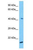 H2BFWT Antibody - H2BFWT antibody Western Blot of HepG2. Antibody dilution: 1 ug/ml.  This image was taken for the unconjugated form of this product. Other forms have not been tested.