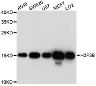 H3F3B Antibody - Western blot analysis of extracts of various cell lines, using H3F3B antibody at 1:1000 dilution. The secondary antibody used was an HRP Goat Anti-Rabbit IgG (H+L) at 1:10000 dilution. Lysates were loaded 25ug per lane and 3% nonfat dry milk in TBST was used for blocking. An ECL Kit was used for detection and the exposure time was 90s.