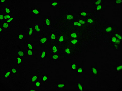 H3F3B Antibody - Immunofluorescence staining of Hela cells diluted at 1:60,counter-stained with DAPI. The cells were fixed in 4% formaldehyde, permeabilized using 0.2% Triton X-100 and blocked in 10% normal Goat Serum. The cells were then incubated with the antibody overnight at 4°C.The Secondary antibody was Alexa Fluor 488-congugated AffiniPure Goat Anti-Rabbit IgG (H+L).
