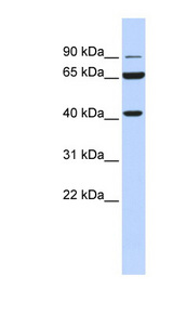 H6PD / G6PDH Antibody - H6PD antibody Western blot of 721_B cell lysate.  This image was taken for the unconjugated form of this product. Other forms have not been tested.