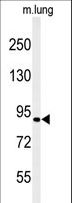 H6PD / G6PDH Antibody - Western blot of H6PD Antibody in mouse lung tissue lysates (35 ug/lane). H6PD (arrow) was detected using the purified antibody.