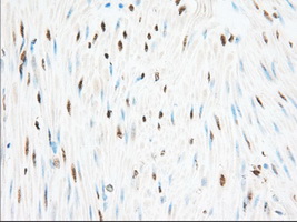 H6PD / G6PDH Antibody - Immunohistochemical staining of paraffin-embedded Human colon tissue using anti-H6PD mouse monoclonal antibody. (Dilution 1:50).