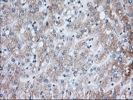 H6PD / G6PDH Antibody - Immunohistochemical staining of paraffin-embedded Human liver tissue using anti-H6PD mouse monoclonal antibody. (Dilution 1:50).