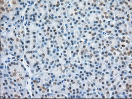H6PD / G6PDH Antibody - Immunohistochemical staining of paraffin-embedded Human pancreas tissue using anti-H6PD mouse monoclonal antibody. (Dilution 1:50).
