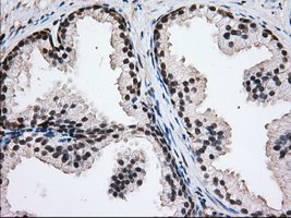 H6PD / G6PDH Antibody - Immunohistochemical staining of paraffin-embedded Human prostate tissue using anti-H6PD mouse monoclonal antibody. (Dilution 1:50).