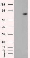 H6PD / G6PDH Antibody - HEK293T cells were transfected with the pCMV6-ENTRY control (Left lane) or pCMV6-ENTRY H6PD (Right lane) cDNA for 48 hrs and lysed. Equivalent amounts of cell lysates (5 ug per lane) were separated by SDS-PAGE and immunoblotted with anti-H6PD.