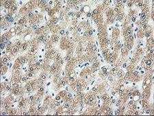 H6PD / G6PDH Antibody - Immunohistochemical staining of paraffin-embedded liver tissue using anti-H6PD mouse monoclonal antibody. (Dilution 1:50).