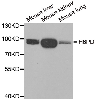 H6PD / G6PDH Antibody - Western blot analysis of extracts of various tissues.