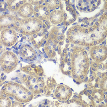 H6PD / G6PDH Antibody - Immunohistochemistry of paraffin-embedded rat kidney tissue.
