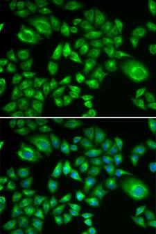 H6PD / G6PDH Antibody - Immunofluorescence analysis of A549 cells.