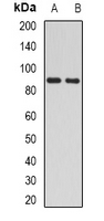 H6PD / G6PDH Antibody - Western blot analysis of H6PD expression in mouse liver (A); mouse kidney (B) whole cell lysates.