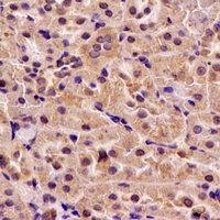 H6PD / G6PDH Antibody - Immunohistochemical analysis of H6PD staining in rat kidney formalin fixed paraffin embedded tissue section. The section was pre-treated using heat mediated antigen retrieval with sodium citrate buffer (pH 6.0). The section was then incubated with the antibody at room temperature and detected using an HRP conjugated compact polymer system. DAB was used as the chromogen. The section was then counterstained with hematoxylin and mounted with DPX.