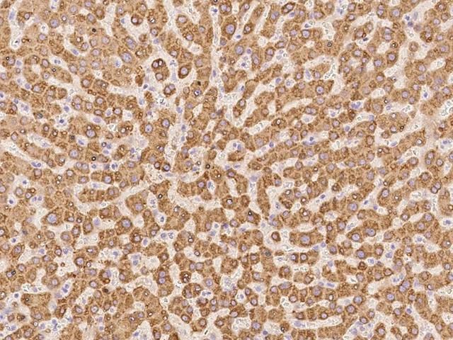 H6PD / G6PDH Antibody - Immunochemical staining of human H6PD in human liver with rabbit polyclonal antibody at 1:100 dilution, formalin-fixed paraffin embedded sections.