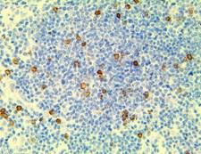 HAAO Antibody - IHC of TCR Delta on an FFPE Thymus Tissue
