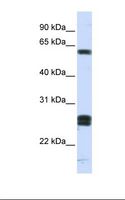 HABP2 Antibody - MCF7 cell lysate. Antibody concentration: 1.0 ug/ml. Gel concentration: 12%.  This image was taken for the unconjugated form of this product. Other forms have not been tested.