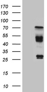 HABP2 Antibody - HEK293T cells were transfected with the pCMV6-ENTRY control. (Left lane) or pCMV6-ENTRY HABP2. (Right lane) cDNA for 48 hrs and lysed. Equivalent amounts of cell lysates. (5 ug per lane) were separated by SDS-PAGE and immunoblotted with anti-HABP2. (1:500)