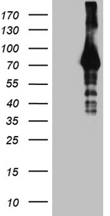 HABP2 Antibody - HEK293T cells were transfected with the pCMV6-ENTRY control. (Left lane) or pCMV6-ENTRY HABP2. (Right lane) cDNA for 48 hrs and lysed. Equivalent amounts of cell lysates. (5 ug per lane) were separated by SDS-PAGE and immunoblotted with anti-HABP2. (1:2000)